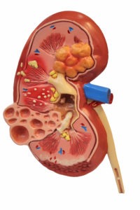 Malpractice Lawsuit Claims Idaho Doctors Accidentally Removed Patient’s Kidney