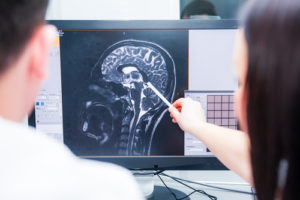A person with locked-in syndrome can communicate, but it is exceedingly difficult, as they cannot talk or move any part of their body other than their eyes. Can Someone With Locked-In Syndrome Communicate?