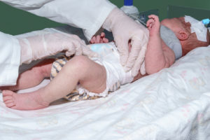 You should file a lawsuit as quickly as possible after a birth injury because you do have a limited time to do so. How Long Can You Wait After Birth Injury To Sue?