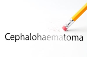 Cephalohematoma is a birth injury in which blood pools between a baby’s skull and brain. Cephalohematoma & Medical Malpractice Law