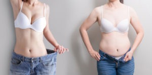 You might know abdominoplasty by its more common name, a tummy tuck. Abdominoplasty And Medical Malpractice Law