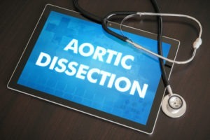 In December of 2018, the U.S. How Does Levaquin Cause Aortic Dissection?